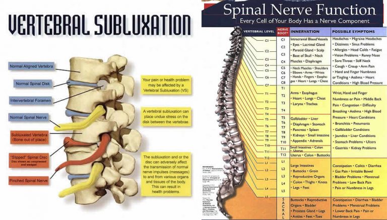 Vertibral Subluxation Spinal Nerve Chart Feldman Wellness Center 3107